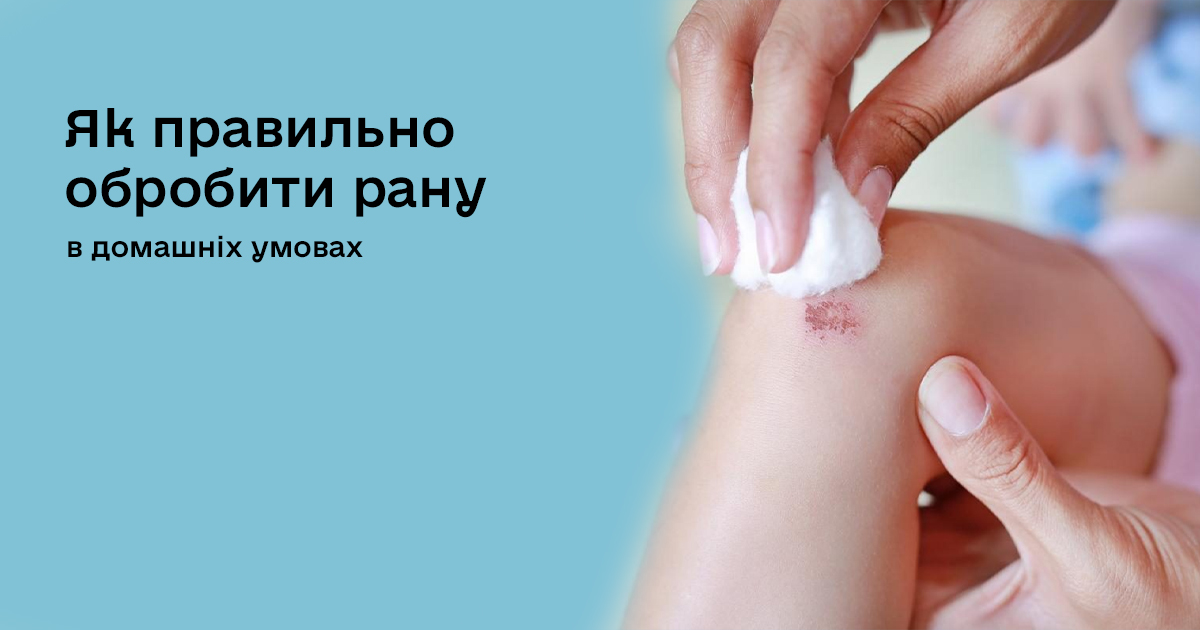 Як правильно обробити рану в домашніх умовах і коли варто йти до лікаря