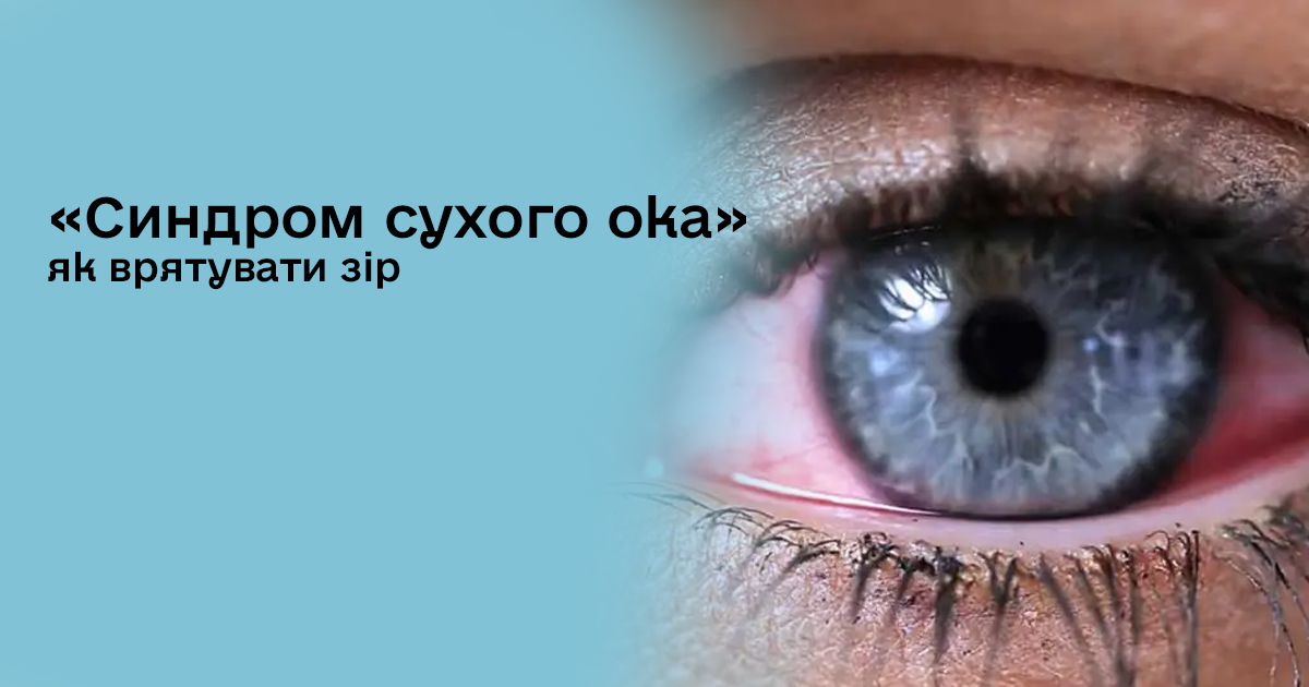 «Синдром сухого ока» у користувачів гаджетів: чому сльозотеча – це теж ознака сухості, та як врятувати зір